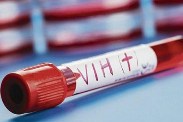 La detección de VIH flaquea en tiempos de covid