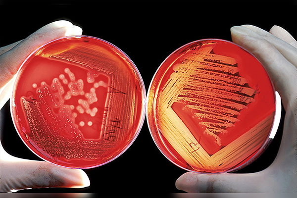 Fallecen 3,500 personas cada día por resistencia antimicrobiana