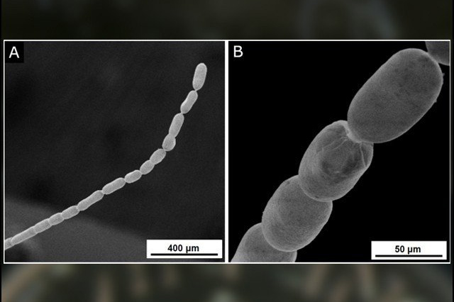 Una enorme bacteria de dos centímetros podría revolucionar la microbiología