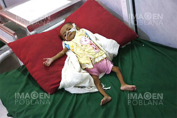 Unicef advierte de hambruna inminente en Yemen debido a guerra y colapso económico