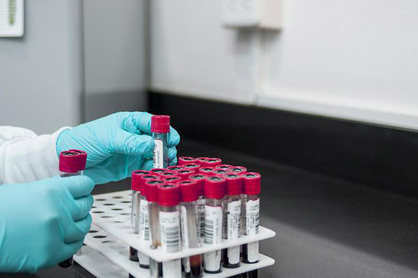 Ya está a la venta la primera prueba que detecta VIH por medio de la saliva