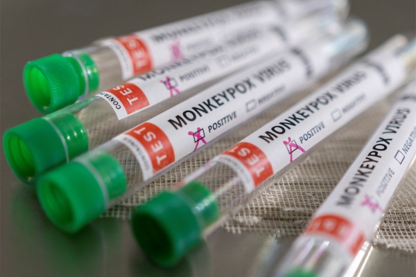 Francia ya suma 16 contagios confirmados de viruela del mono