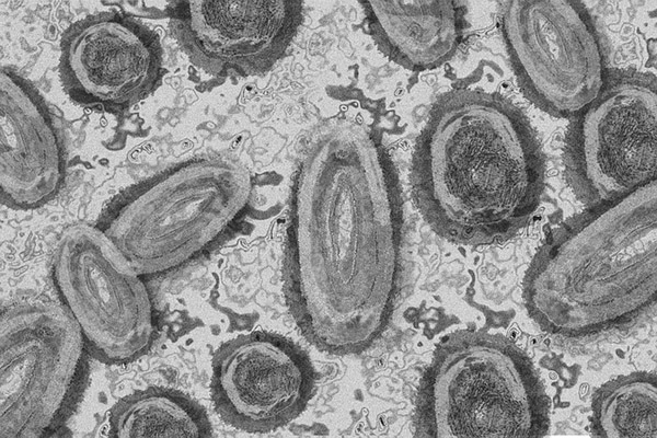 Detectados más de 550 casos de la viruela del mono en 30 países