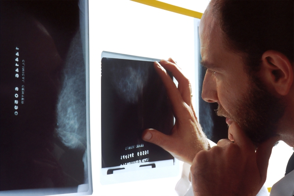El cáncer podría llegar a ser la primera causa de mortalidad en 2050