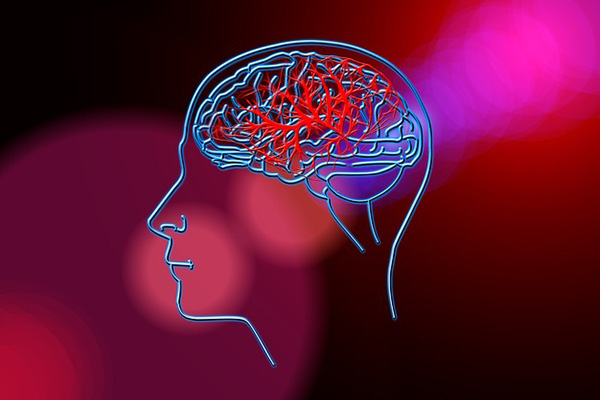 ¿Cómo detectar a tiempo enfermedades cerebrovasculares?