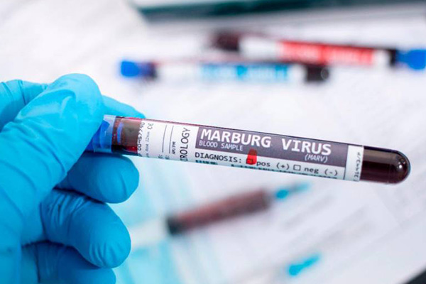 Radiografía del virus de Marburgo, esto sabemos del “primo” del Ébola