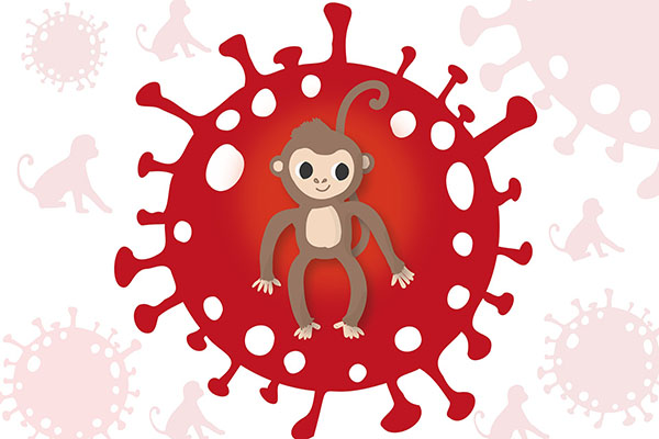 Reino Unido supera los 2,000 contagios por viruela del mono
