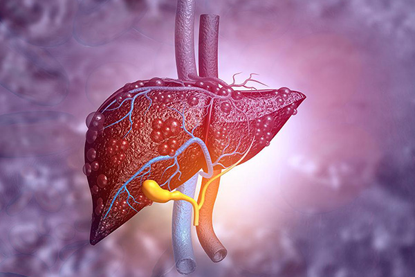 Contingencia por COVID-19, vinculada al origen de la hepatitis infantil aguda: estudio