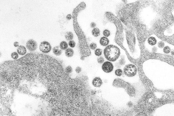 Llega a 164 número de muertos por fiebre de Lassa en Nigeria