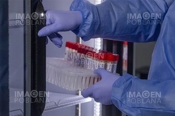 Más de 15,500 casos confirmados de la viruela del mono y dos muertes en Europa