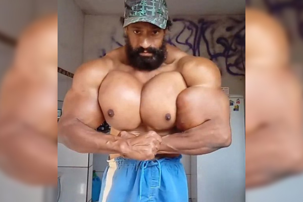 Muere el famoso “Hulk brasileño” tras inyectarse sustancias que aumentaban su musculatura