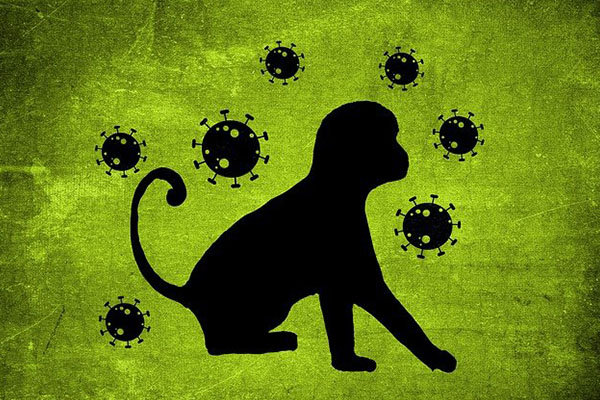 Bolivia descarta emitir medidas restrictivas para enfrentar viruela del mono