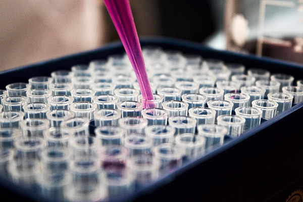 Investigadores de universidad colombiana logran aislar virus de la viruela símica