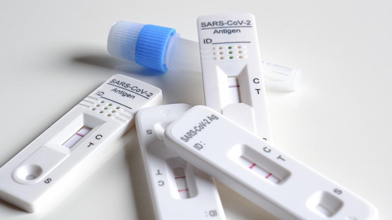 Nivel de antígenos de SARS-CoV-2 en sangre, vinculado con severidad de enfermedad