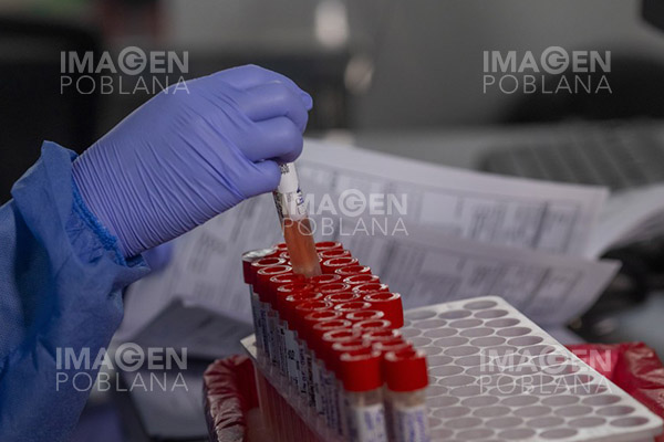 Avala agencia sanitaria de Brasil prueba diagnóstica para viruela del mono