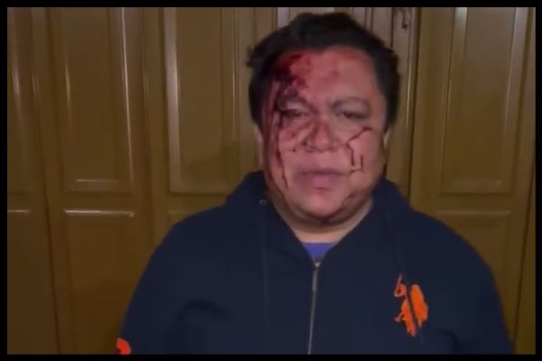 Líder sindical del Ayuntamiento, con rostro ensangrentado, acusa actos de intimidación