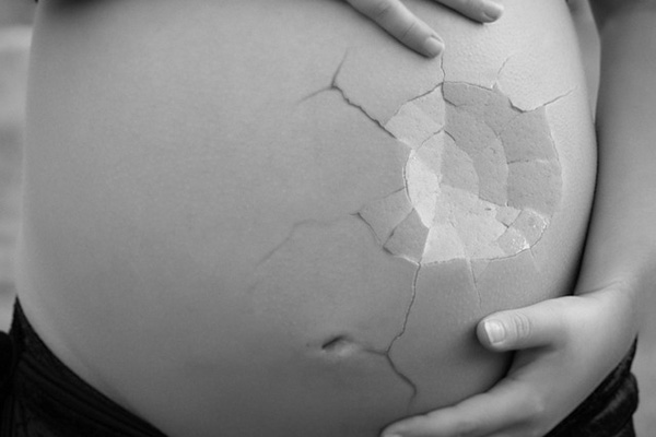 Industria del aborto es un negocio millonario de potencias extranjeras: Mujeres Libres y Soberanas