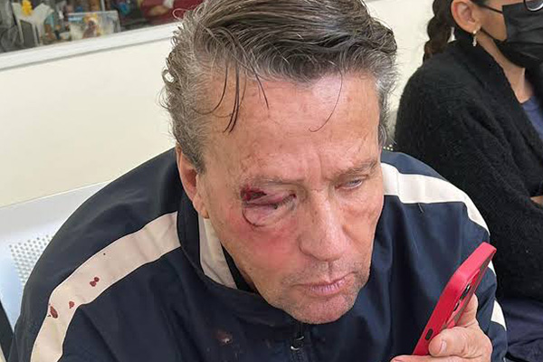 Adame, con la golpiza, debe estar feliz: volvió a ser el centro de atención
