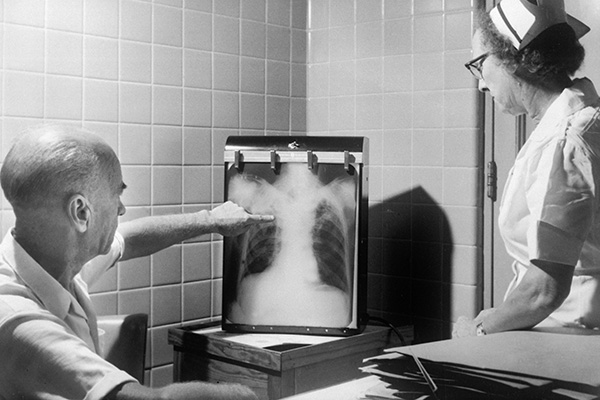 OMS reporta más de 10.5 millones de casos positivos de tuberculosis en el mundo en 2021