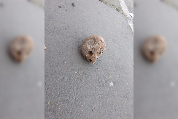 Abandonan cráneo humano en plena calle