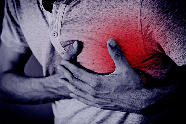 Infartos: ¿cuáles son sus síntomas y cómo actuar ante uno?