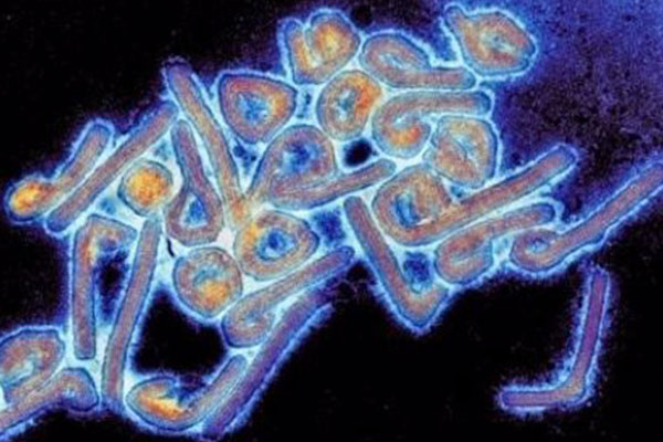 Brote de virus de Marburgo en Guinea Ecuatorial pone en alerta a la OMS