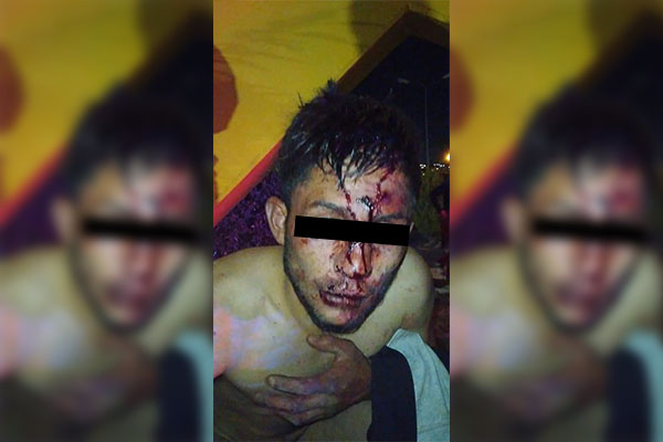 Asaltante de taxista acaba desnudo y vapuleado por vecinos