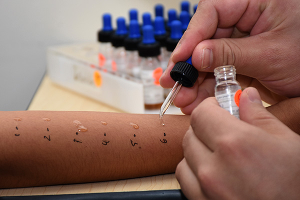 HUP lleva a cabo estudios de sensibilidad de vacunas contra SARS-CoV-2 en pacientes con alergia