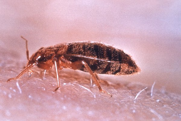 "No hay casos confirmados", dice Gobierno de Francia sobre plaga de chinches