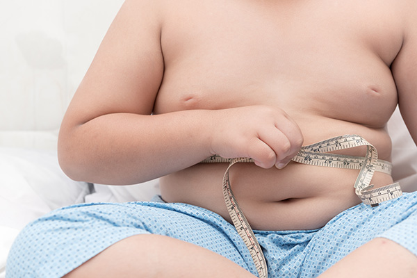 Obesidad infantil: un problema que no solo se trata de sobrepeso