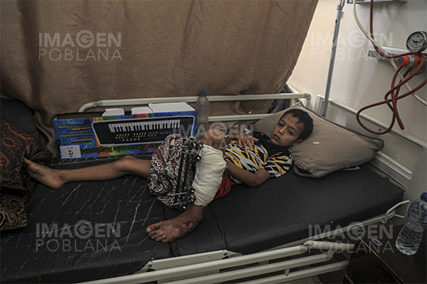 Cada día, 10 niños pierden una o ambas piernas en Gaza: UNRWA