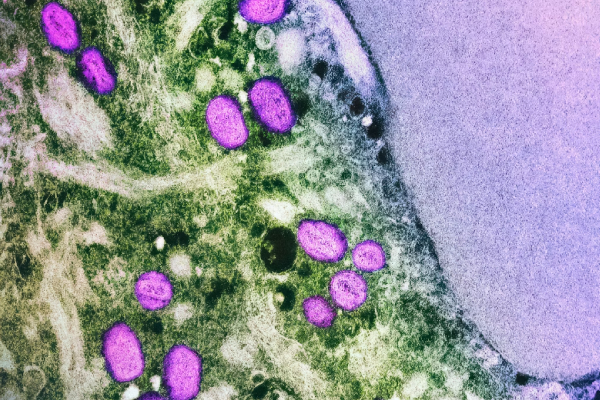 ¿Próxima pandemia? Así es la nueva cepa de la viruela del mono que alarma al mundo