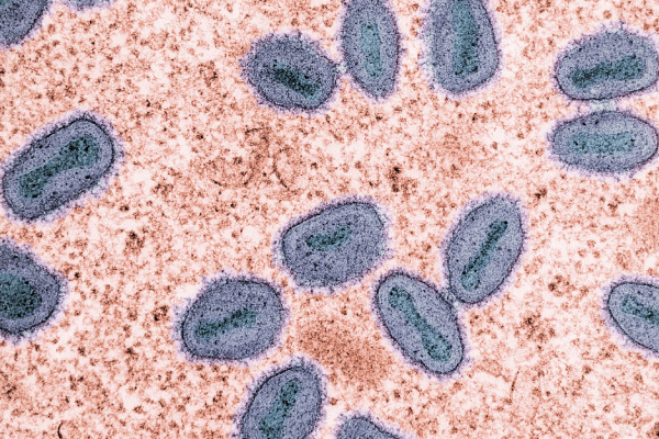 Perú emite alerta epidemiológica para fortalecer prevención ante viruela del mono