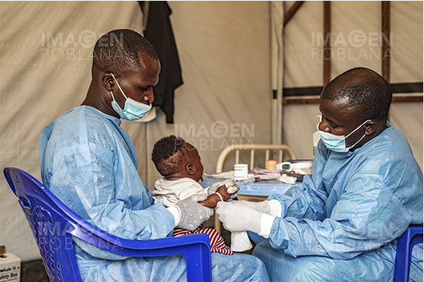 CDC de África advierte de aumento de casos de mpox; cifra de muertos se eleva a 643