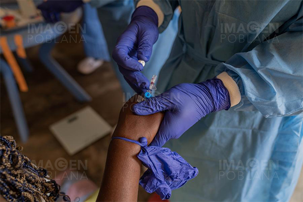 África registra más de 25,000 casos de viruela del mono en 2024
