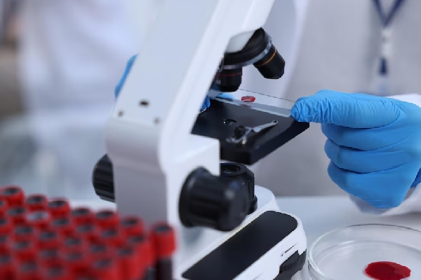 EU registra una muerte por fiebre de Lassa, la enfermedad que hace sangrar los ojos