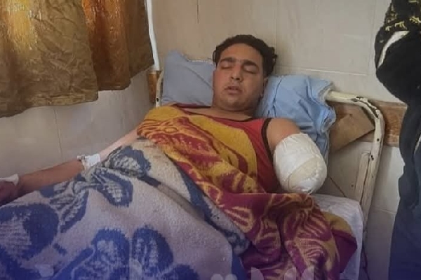 Pánico en el circo: feroz tigresa le arranca el brazo a su domador en pleno show