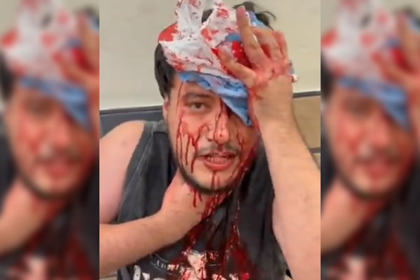 FGE investiga ataque a Fabián Barrales como intento de homicidio