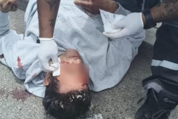 Hombre resulta gravemente herido tras ataque con machete