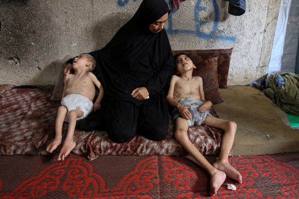 Índices de desnutrición en la Franja de Gaza superan los valores máximos, según la ONU