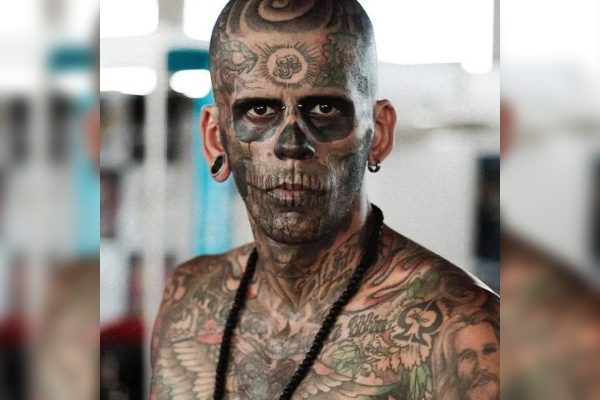 Nuevo rostro: hombre soporta dolorosas sesiones láser para borrar los tatuajes de su cara
